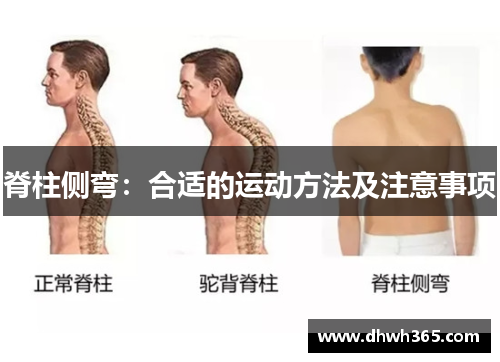 脊柱侧弯：合适的运动方法及注意事项